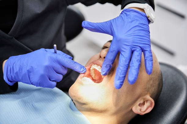 Best Emergency Root Canal Therapy in Centennial, CO
